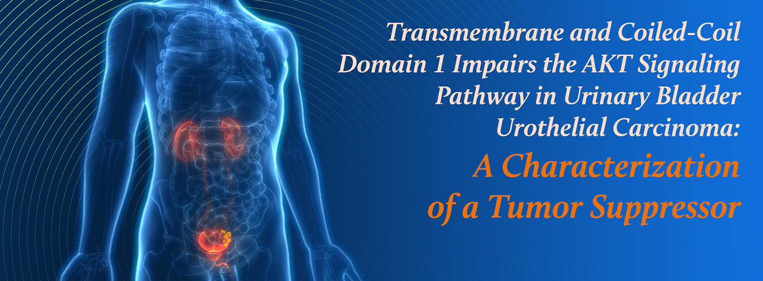 Transmembrane and Coiled-Coil Domain 1 Impairs the AKT Signaling Pathway in Urinary Bladder Urothelial Carcinoma: A Characterization of a Tumor Suppressor